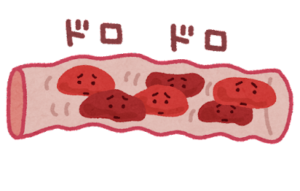 血液ドロドロの血管